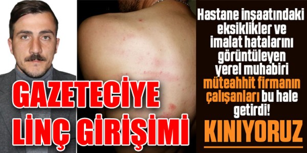 GAZETECİYE LİNÇ GİRİŞİMİ