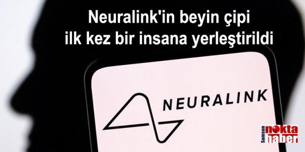 Neuralink'in beyin çipi ilk kez bir insana yerleştirildi